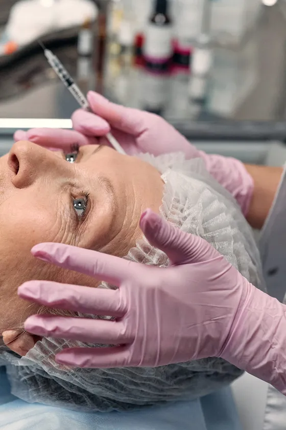 Forehead Filler di Laasya Derma Clinic — membuat kontur dahi lebih halus dan berisi
