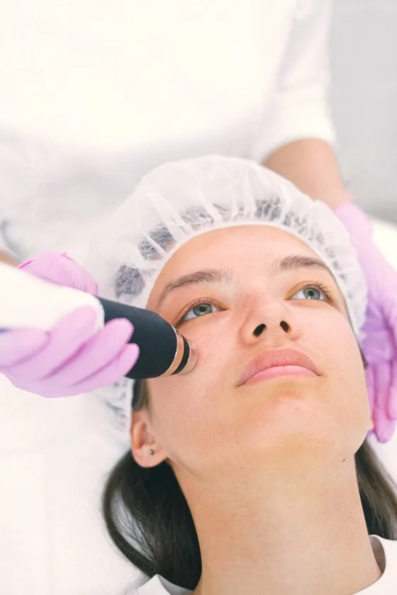 IPL (Intense Pulsed Light) di Laasya Derma Clinic — meratakan warna kulit dan meredakan kemerahan