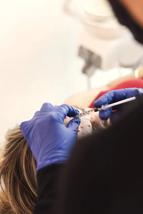 Nose Thread Lift di Laasya Derma Clinic — menegaskan garis hidung dengan benang, tanpa operasi